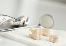 Several extracted teeth on a pieces of gauze next to dental instruments