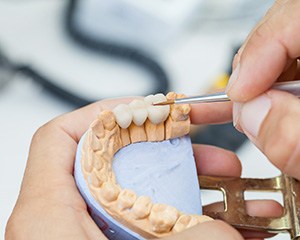 A dental technician working on a dental bridge