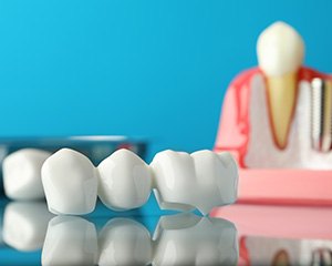 A dental bridge with dental tools in the background